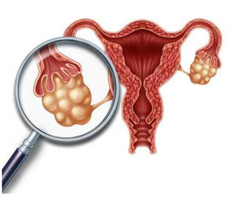 子宫纵隔长一厘米严重吗，会影响到试管胚胎着床吗~试管代孕借卵子