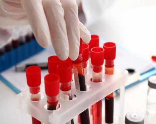 艾滋病做试管婴儿多少钱?