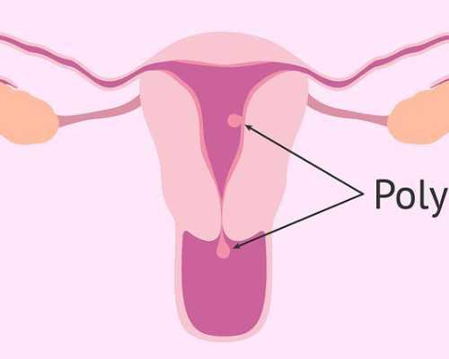 乌克兰试管婴儿中介有哪些骗局,揭晓乌克兰试管婴儿中介的骗局~医院可以做代孕吗