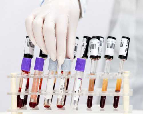 [乌克兰做试管骗局]乌克兰试管中国中介~医院 代孕