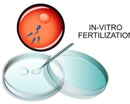 难孕之宫腔粘连适不适合做试管婴儿治疗?