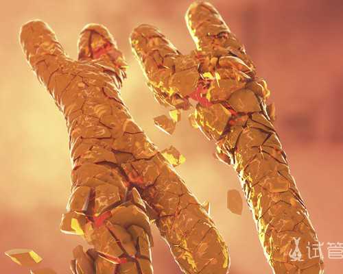 做彩超可以看出多囊卵巢综合症吗