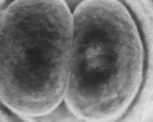 泰国做三代试管婴儿选男孩全程消费要多~借卵代怀价格