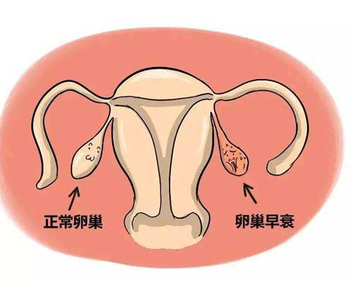 杭州古玩交易正规公司_男士防止腹部脂肪堆积的绝招