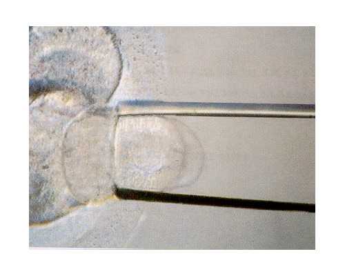 6周香港验血鉴定男女准吗多少钱_40多天验血查男女准吗？专业验血机构为准爸