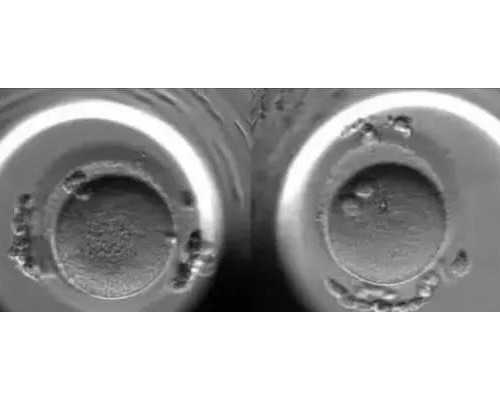 孕妇抽血到香港验血_香港验血林顾问_验血的流程和手续如何办理