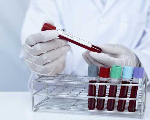 去香港医院验血要先预约吗_香港验血报告单空白准不准_验血查男女要几周看完