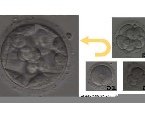 香港验血检测男女机构有几家_香港验血正规中介，谁帮忙科普一下！