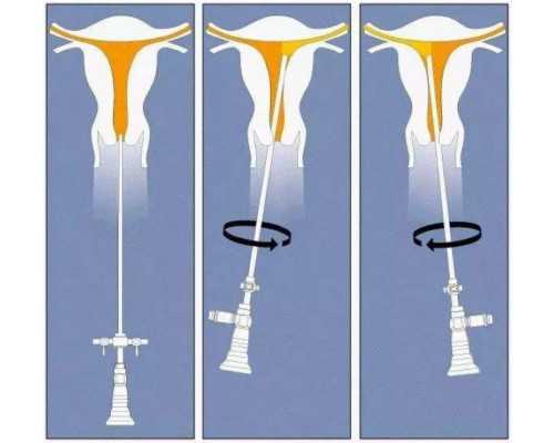 香港弘高医疗化验所验血准吗_移植后多久去香港查男女_科学吗时间是多久!