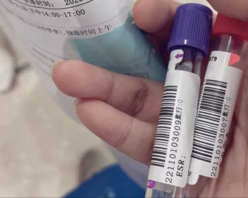 香港验血b超单要见到孕囊还是胎牙_香港dna性别鉴定到底多少钱?总结下香港鉴