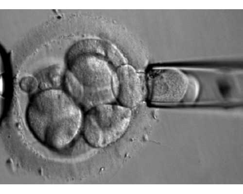 香港尹镇伟验血多少钱_香港验血染色体有y就是男孩吗,怀孕在香港哪里验血好