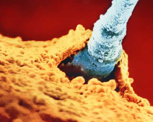 香港验血性别准确率高吗_正规香港胎儿性别判定,查性别哪个组织最威望