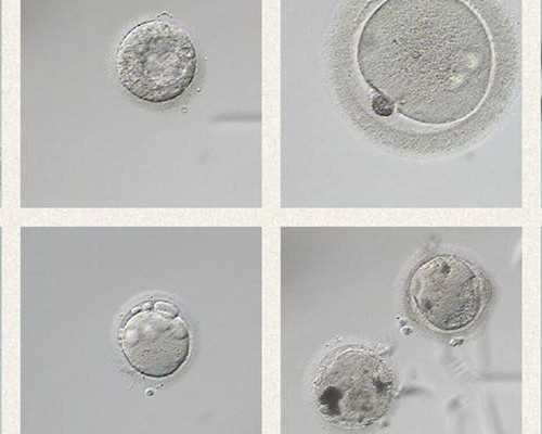 香港邮寄验血要注意什么_香港的验血辨男女靠谱吗_怎么个流程价格是多少