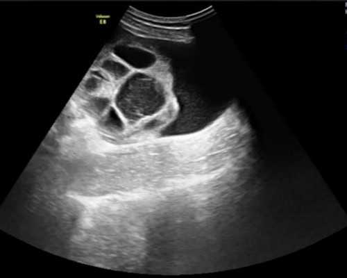 香港验血检测男女价格_香港验血查男女要多少天,查性别详细流程是什么?