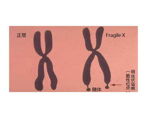 香港验血孕囊多大_3.15工厂服装店的活动策划如何写正规的活动策划有关3.15的