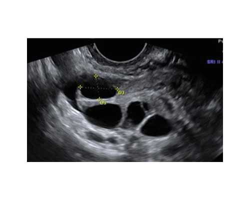 香港验血报告全是多少钱_香港验血看男女报告单准不准_验血查男女准不准!