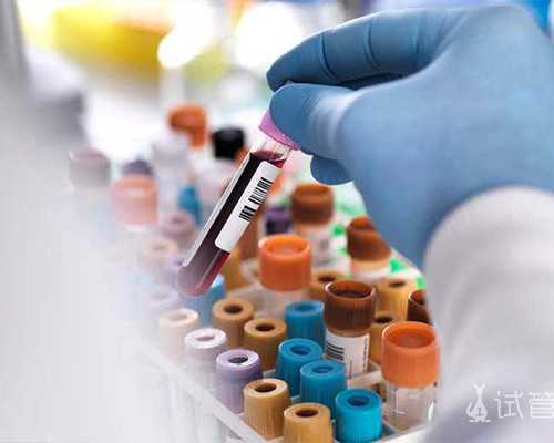 香港的哪些诊所验血_香港验血报告16个阳性_验血查男女哪个机构最好