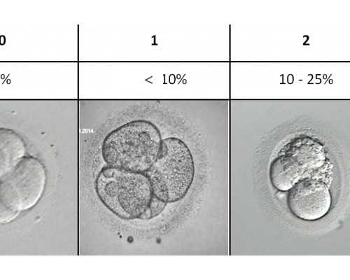 怀孕六周能做香港验血吗_香港验血男女什么医院好_验血B超男孩会翻盘吗!