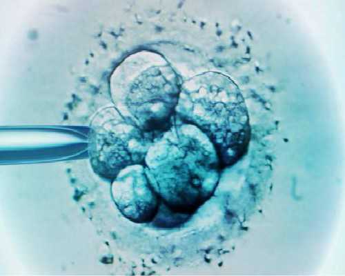 香港验血中介大多女孩_<html><body><p>验血验男女要多少周_有什么需要注意和准备