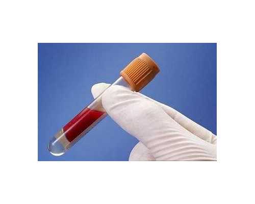 香港验血鉴定怎么邮寄_怀孕几周可以在香港验血查性别_最具权威的验血机构是