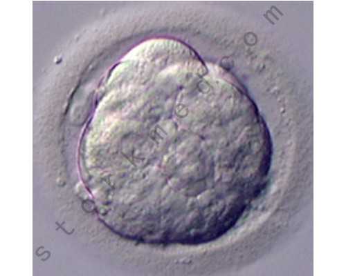 香港验血几天的血准确率高吗_小诊所验血结果准确吗_验血的准确率高吗