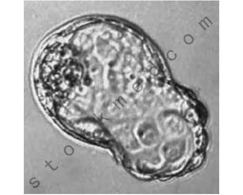 香港验血不要化验报告便宜_到香港验血攻略_验血查男女哪家最权威!