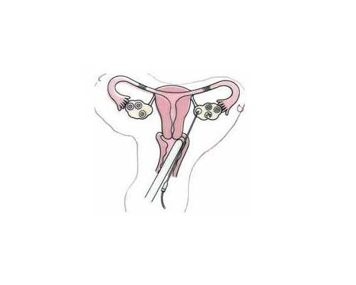 孕50天香港验血_香港验血报告单是假的准不准,亲身经历分享