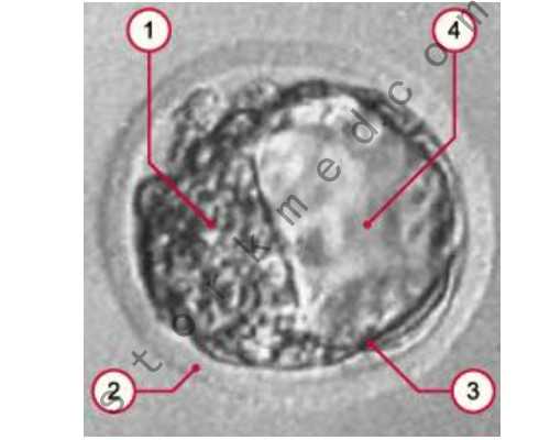 古玩大亨楚辞 小说下载_中国买家10.3亿购克里姆特女人画作 中间人高古轩