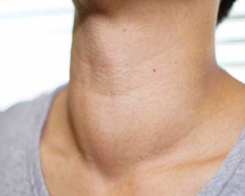 香港验血报告y是男孩还是女孩_邮寄香港验血3500元,哪家诊所准确率最高