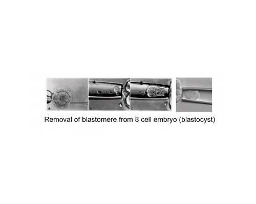 香港验血 预约网_香港什么医院能验血看男女?早知道早准备