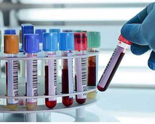 香港美亚验血地址_怀孕香港验血查性别多少钱在哪个医院,性别鉴定需要满足哪