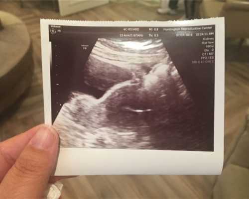 怀孕到香港验血查男女有什么要求_香港验血鉴定胎儿性别,宝妈亲身经历告诉你