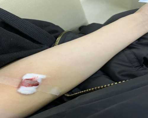 怎么下载宝库古玩网_做头颅MRI检查痛苦吗