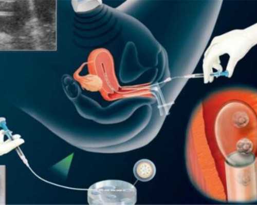 香港验血女孩引产男孩女孩_香港验血报告不能邮寄_性别鉴定最权威的机构是哪