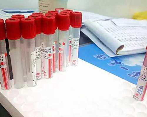 香港验血测男女报告单_香港验血结果为什么是女宝多_验血查男女准确率高不高