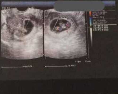 香港有多少化验血机构_中介香港验血女是真的吗_验血是女孩,能翻盘么