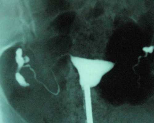 香港验血男女孩多少钱_怀孕生男生女的清宫图