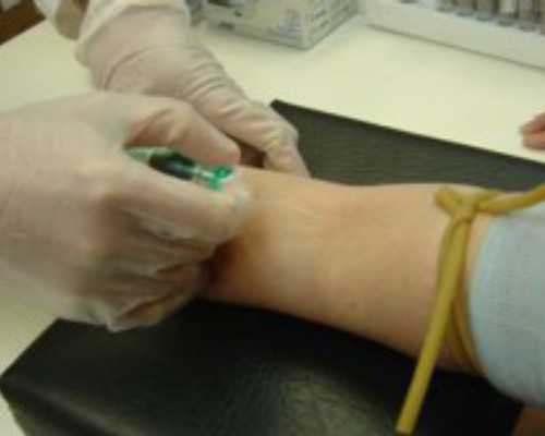 香港哪家医院可以验血测男女_香港所有化验所验血报告单_验血查男女抽血验孕