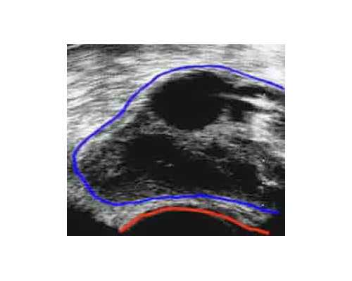 孕酮低香港验血验不出吗_香港查男女是真的吗_希望可以帮到你