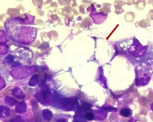 南昌寄血去香港验血准吗_香港验血有Y但浓度不够_DNA查男女需要什么条件