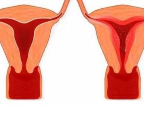 沈阳古玩鉴定权威机构_糯米圆子银耳羹