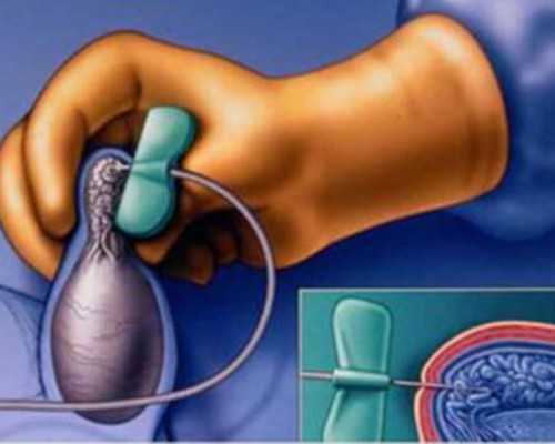 引产男孩5个月后香港验血准吗_香港验血机构哪家准准不准_我的经历,给你更多