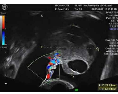 香港验血 邮寄血样_香港验血多少人民币_分享我去香港验血的亲身经历