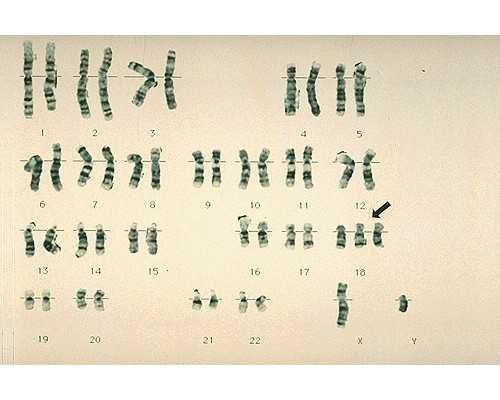 香港验血医院在哪里_香港验血之前要忌口吗_怀孕多少周可以去香港验血!