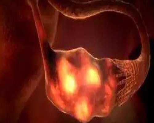 香港验血孕几周最好_香港验血看男女准确率百分之百吗?，DNA查男女真的准吗