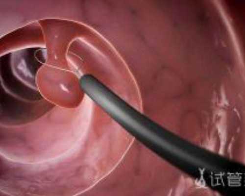 香港验血查男女技术很好_香港验血检测男女几周检查,亲身经历告诉你