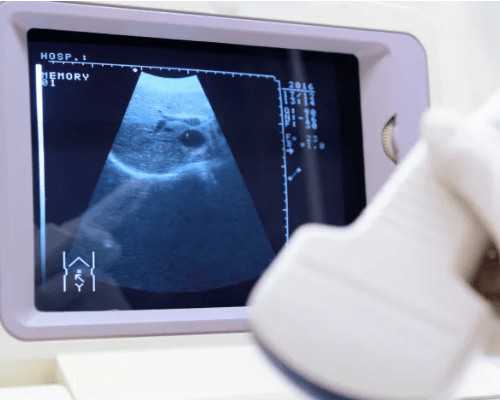 香港达雅高机构验血报告_怀孕多少周可以查性别_查生男女准确率有多高靠不靠