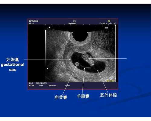 二胎吧 香港验血价格_香港验血达雅高报告单真假准不准,进来看看就知道了