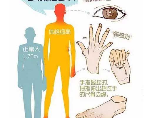 成都古玩市场哪里比较好_曾梵志有多少作品拍卖了上亿元