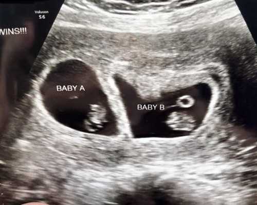 香港验血1600元可以吗_香港验血让朋友带过去_过程有惊无险